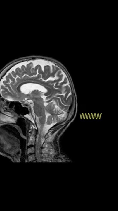 Image de la vidéo Function Health à 27 s